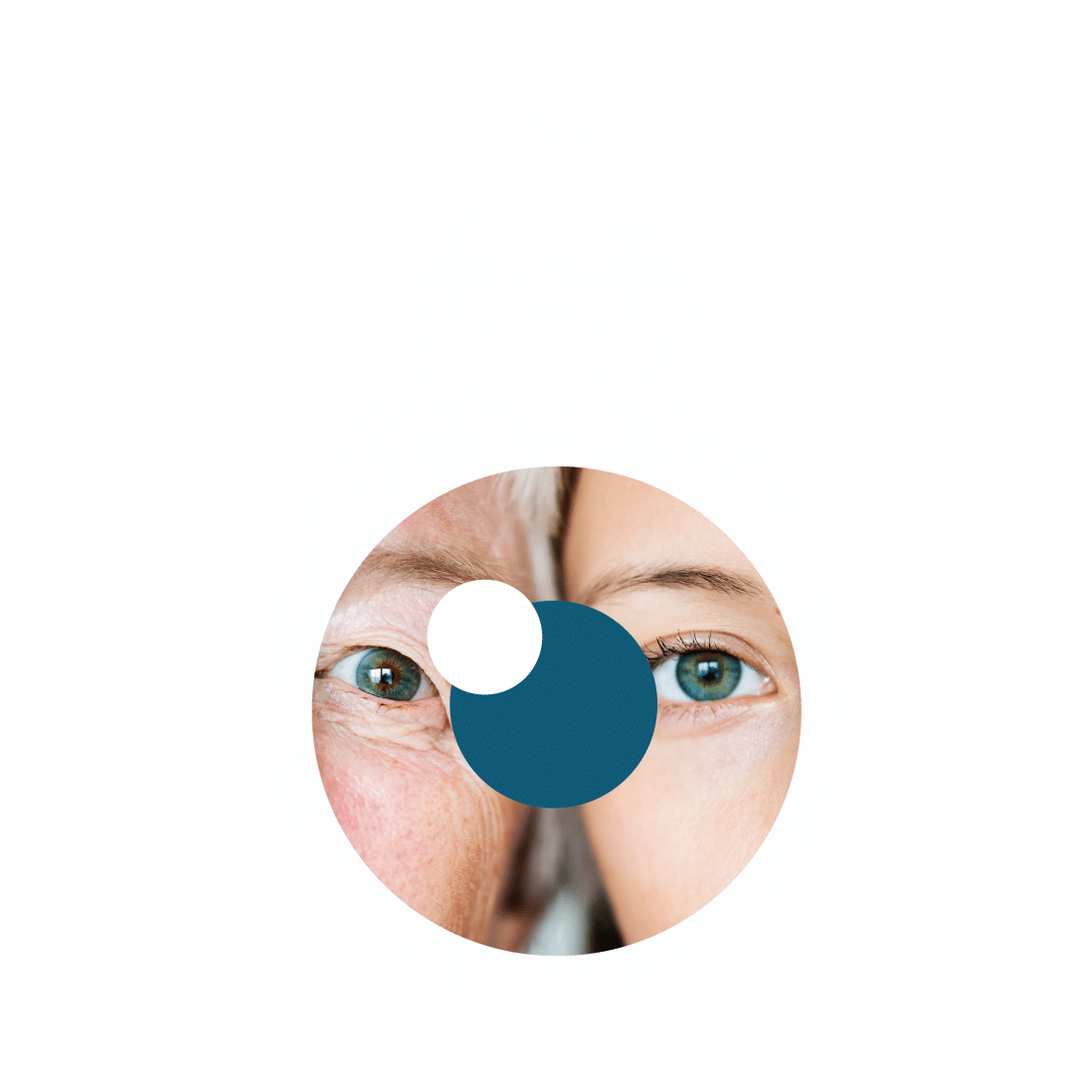 hylo gel cauze și simptome ale ochiului uscat